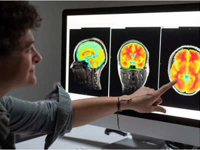 Estimulação Magnética Transcraniana (EMT)